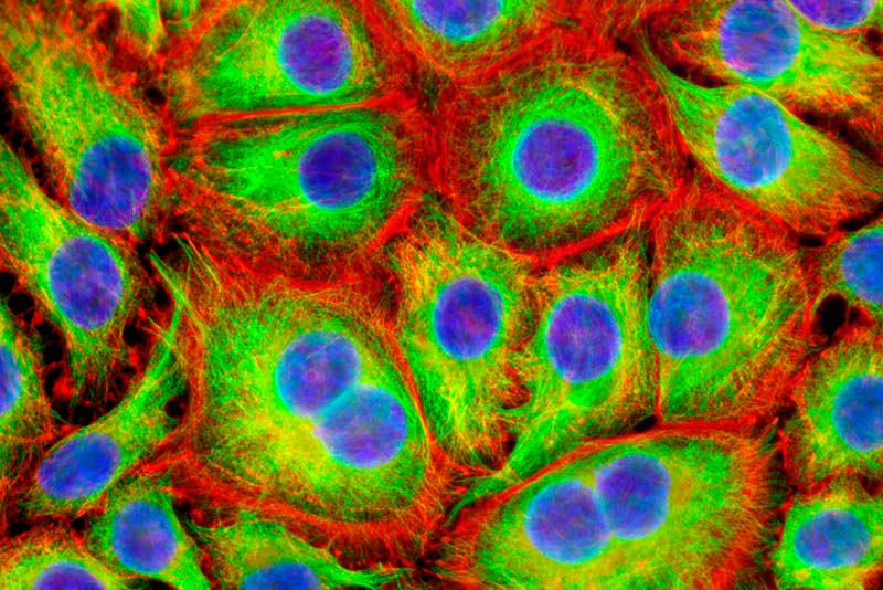 Cancer cells. Life Science.